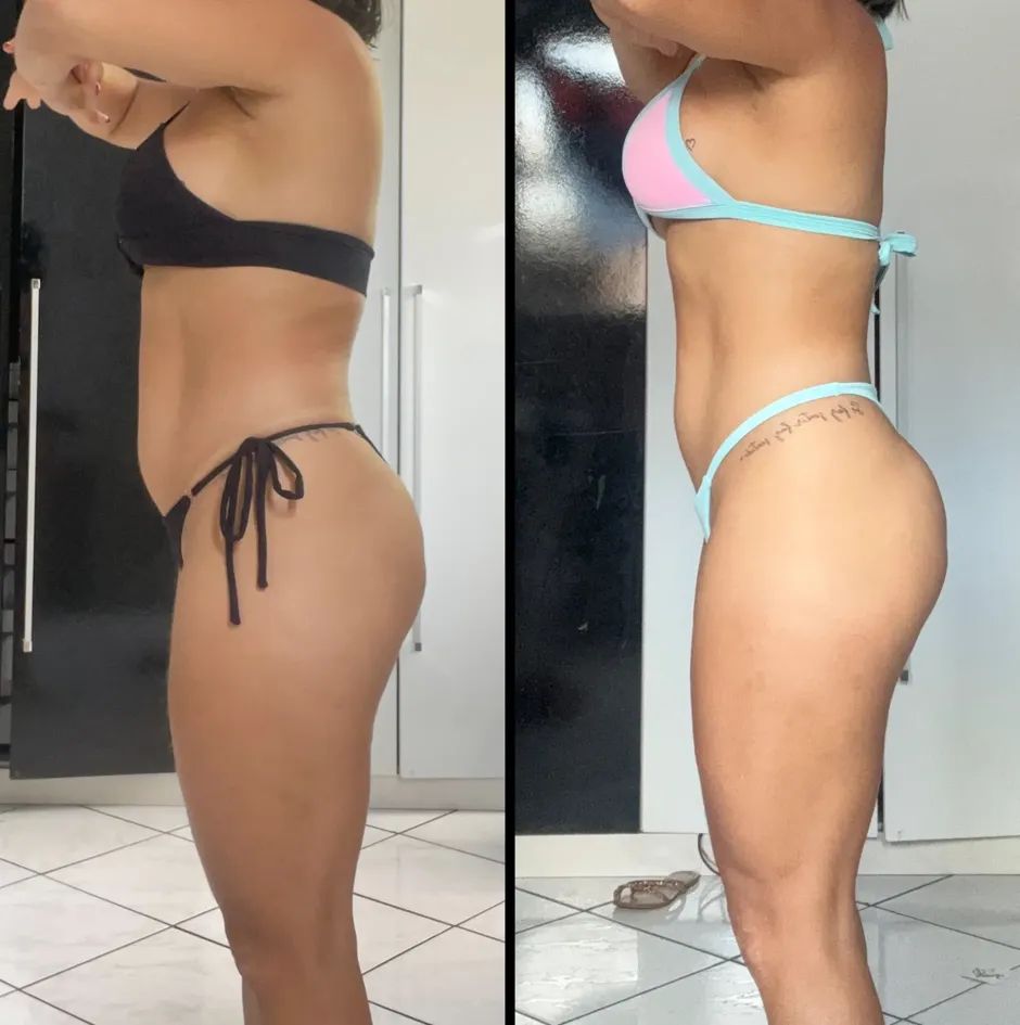 22